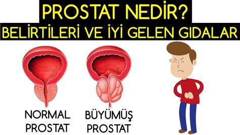 Prostat Ned R Bel Rt Ler Ve Tedav Eden Gidalar Youtube