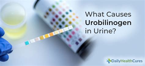 Urobilinogen 10 Possible Causes Diagnosis Treatments And Prevention