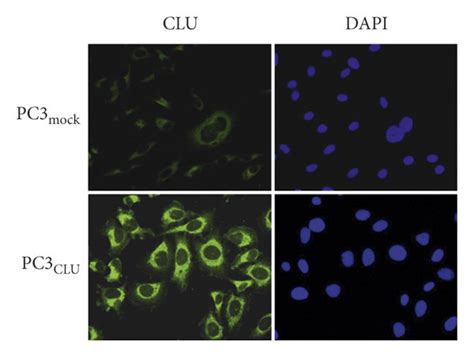 Clu Stable Overexpression And P Expression And Phosphorylation In Pc