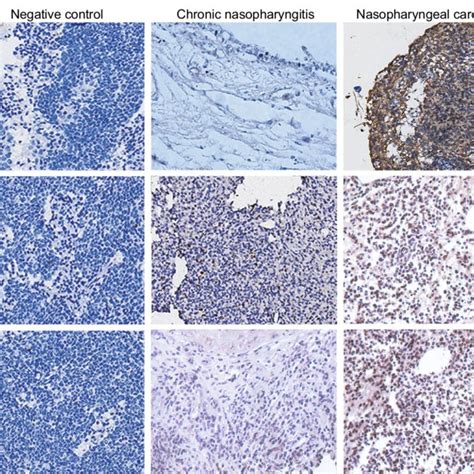 Immunohistochemical Analysis On Expression Of β Catenin Tcf 4 And Download Scientific Diagram