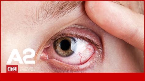 diabeti  syrit semundja nga  cila duhet te bejme te gjithe kujdes