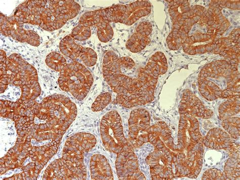 Pathology Outlines Ihc Procedure