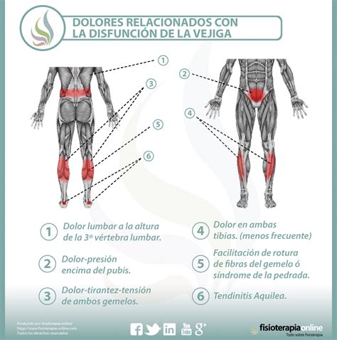 Relación Entre Vejiga Y Dolor De Piernas Y Espalda Fisioonline