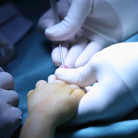 Hand Surgery | A/Prof Mark Gianoutsos