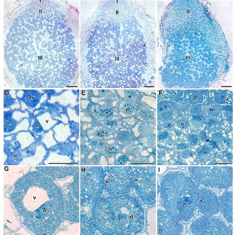 Phenotypes Of Plants And Nodules Of Pea Pisum Sativum L Laboratory