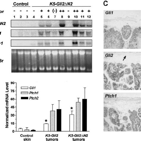 Expression Of Gli2 ⌬ N2 Mrna And Shh Target Genes In Skin Tumors A