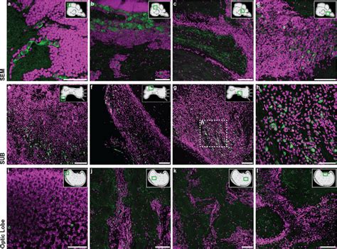 Rte Ov Immunostaining In Different Areas Of The Brain Coronal