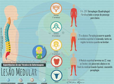 Lesão Medular Enfermagem Ilustrada