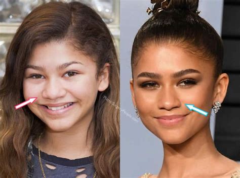 Zendaya: BEFORE and AFTER 2022