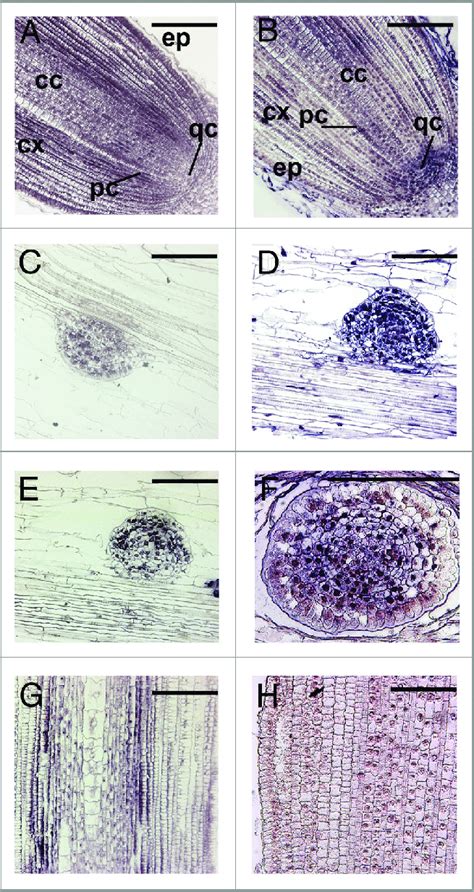 Comparison Of In Situ Hybridization Signal Detections Of Zmamir A B