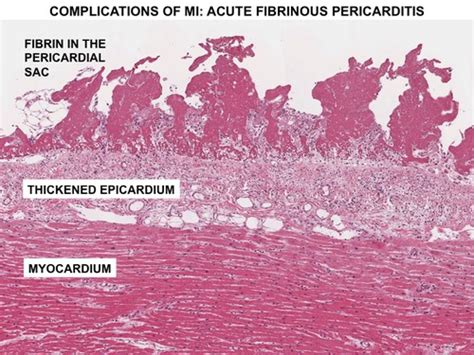 Visceral Pericardium Histology 338x360