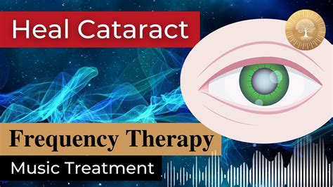 Cataract