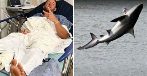 'It felt very surreal': Florida surfer 'having nightmares' after shark attack
