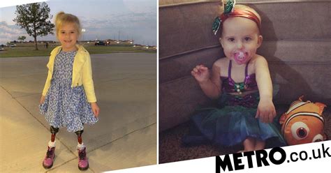 'She's doing amazing things': Girl born with fused legs takes first steps