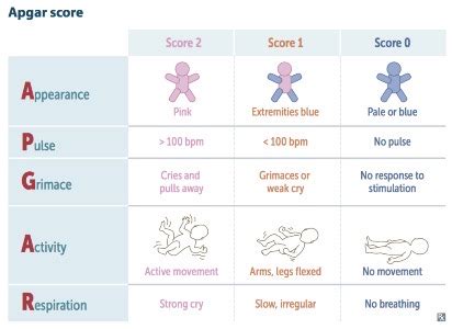 (M 1) Newborn Assessment Flashcards Quizlet