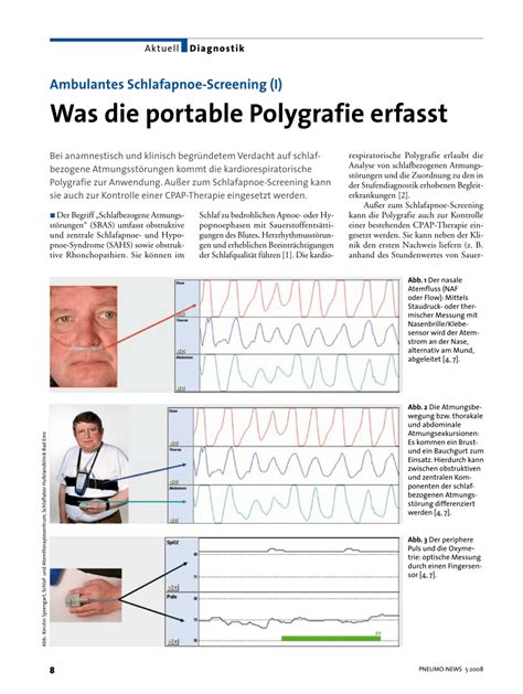 (PDF) Ambulantes Schlafapnoe-Screening (I) Was die