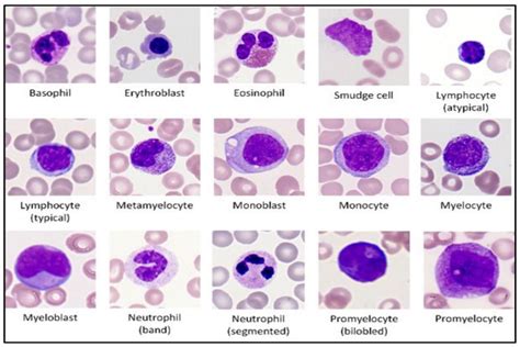 (PDF) IDENTIFICATION AND DETECTION OF IMMATURE WHITE