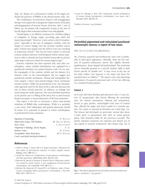 (PDF) Melanocytic Nevus - researchgate.net