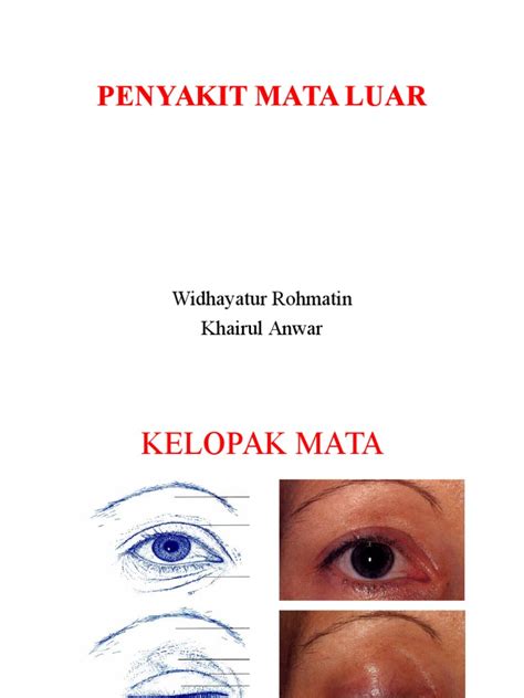 (PDF) Penyakit Mata 1 - DOKUMEN.TIPS