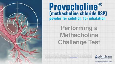 (PDF) Performing a Methacholine Challenge Test Select