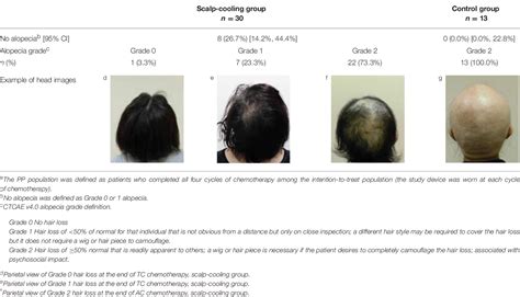 (PDF) Safety and efficacy of scalp cooling system in preventing ...