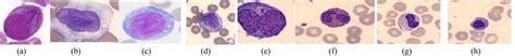 (a) Myeloblast. (b) Promonocyte. (c) Monoblast. (d) Myelocyte. (e ...