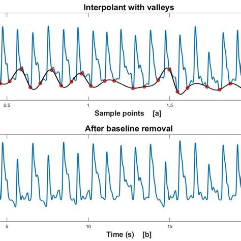 (a)Baseline with cubic spline interpolation and (b) Baseline wandering