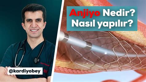 anjiyo nedir nasıl yapılır