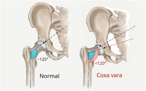 💋 @Lala_Coxa Onlyfans Leak (SEX) 238 Pics