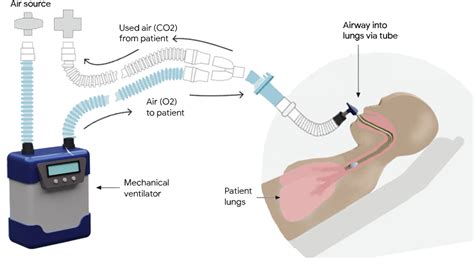 [2102.06779] Machine Learning for Mechanical Ventilation Control …