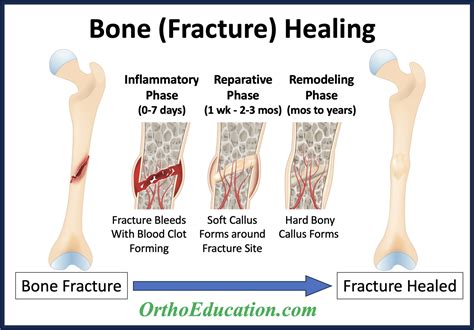 [Fractures and fracture healing in prehistoric and early ... - PubMed - wintechmobiles.com
