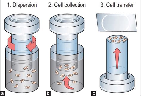 [Liquid-based cervical cytology ThinPrep screening in Hungary].