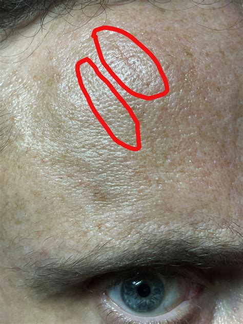 [MISC] Copper peptide "uglies" and sagging from Argireline ... - Reddit