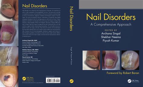 [PDF] The Print Of The Nails Book Full Download - PDFneed