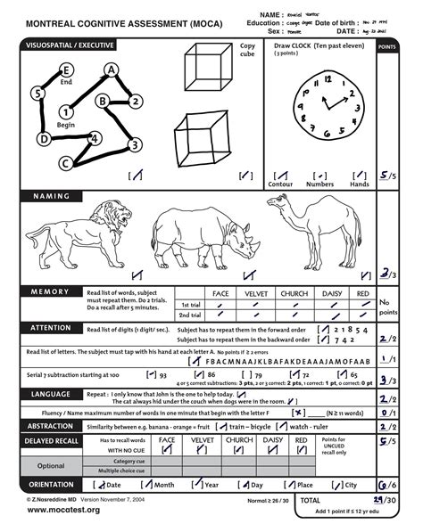 [Solved] Please administer the MOCA Test to a peer and then report the