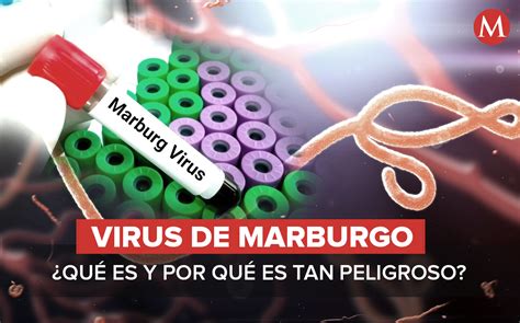 ¿Qué debes saber sobre el virus de Marburgo? La explicación de nuestra analista médica