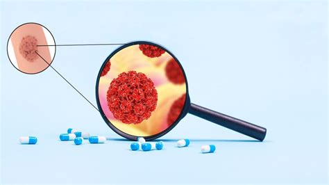 Çankırı Genital Siğil Tedavisi Aktıp Hastanesi. 