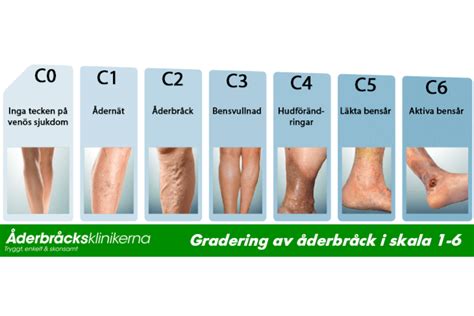 åderbråcksklinikerna