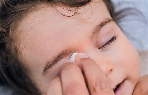 ögoninflammation barn bada