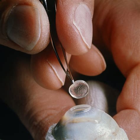 ögonoperation hund pris