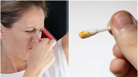 öronvaxet luktar illa