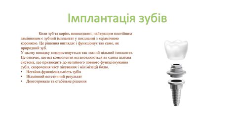 Імплантація astra