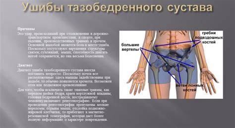 Как облегчить боль в тазабедренном суставе без лекарств