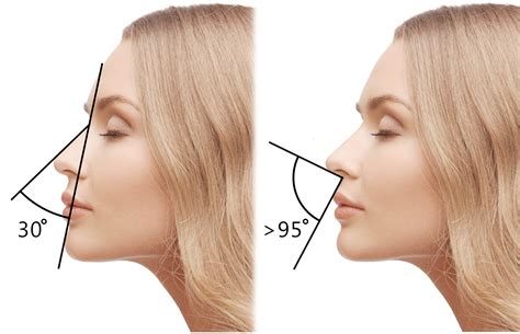 Как меняется форма носа с возрастом?