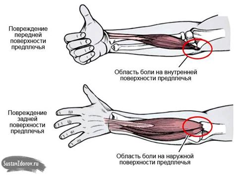 Обследование болей в локтевом суставе