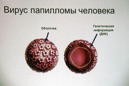 Папилома вирус по време на бременност - comercialexposito.com