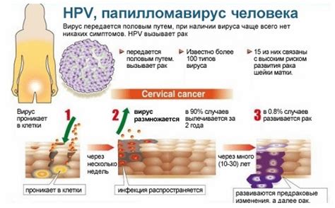 Човешкия папилома вирус се предава по полов път - comercialexposito.com