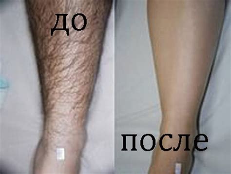 th?q=длинные+волосы+на+ногах+у+женщин+сонник+сонник+волосы+на+ногах+женщине