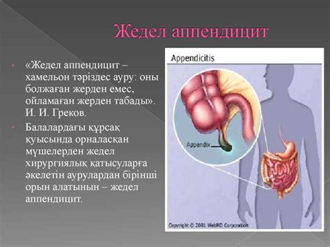 th?q=жедел+аппендицит+симптомдары+жедел+аппендицит+кезіндегі+алғашқы+көмек