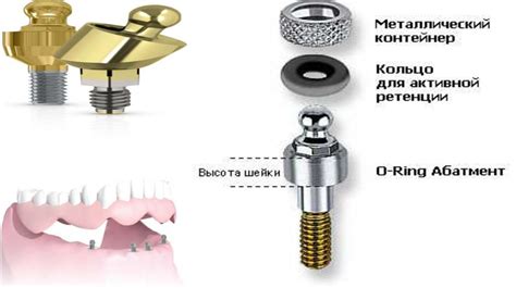 th?q=имплант+тіс+бағасы+керамикалық+тіс+бағасы+алматы